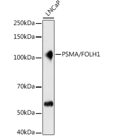PSMA/FOLH1 Rabbit Monoclonal Antibody