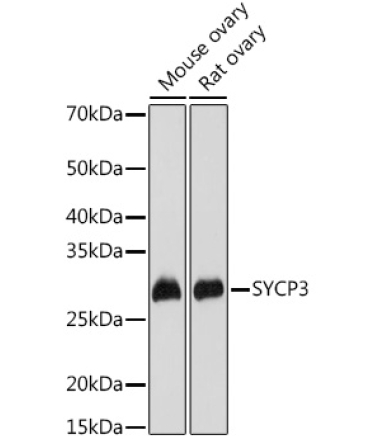 SYCP3 Rabbit Polyclonal Antibody