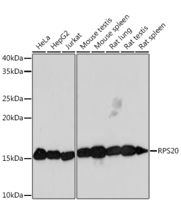 RPS20 Rabbit Monoclonal Antibody