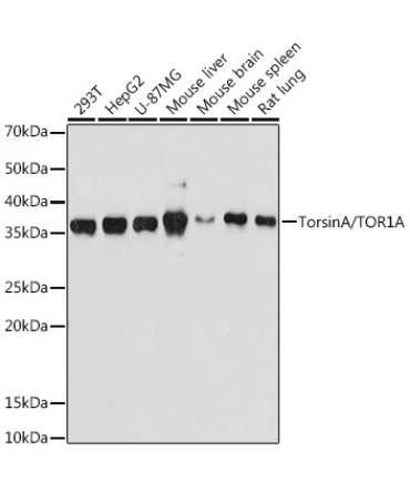 TorsinA/TOR1A Rabbit Monoclonal Antibody