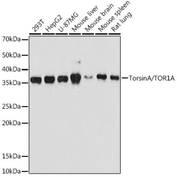 TorsinA/TOR1A Rabbit Monoclonal Antibody