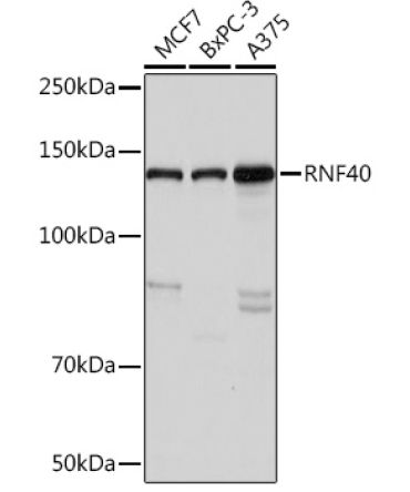 RNF40 Rabbit Monoclonal Antibody