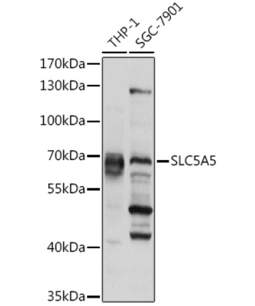 SLC5A5 Rabbit Polyclonal Antibody