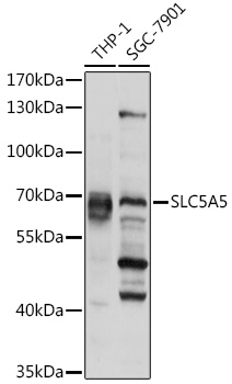 SLC5A5 Rabbit Polyclonal Antibody