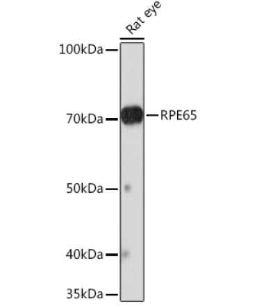 RPE65 Rabbit Monoclonal Antibody