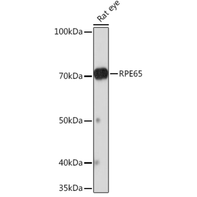 RPE65 Rabbit Monoclonal Antibody
