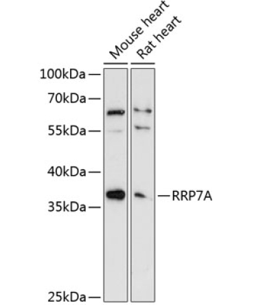 RRP7A Rabbit Polyclonal Antibody