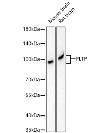 PLTP Rabbit Monoclonal Antibody
