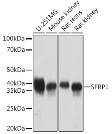 SFRP1 Rabbit Monoclonal Antibody