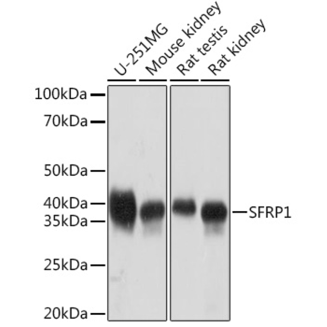 SFRP1 Rabbit Monoclonal Antibody