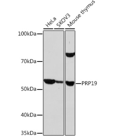 PRP19 Rabbit Monoclonal Antibody