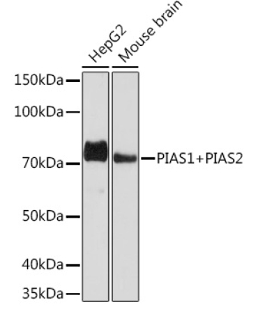 PIAS1+PIAS2 Rabbit Monoclonal Antibody