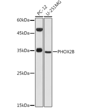 PHOX2B Rabbit Polyclonal Antibody