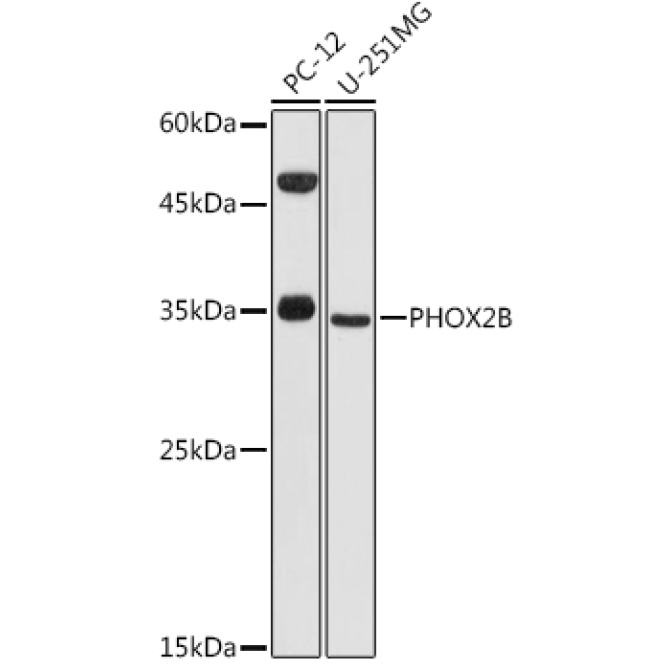 PHOX2B Rabbit Polyclonal Antibody