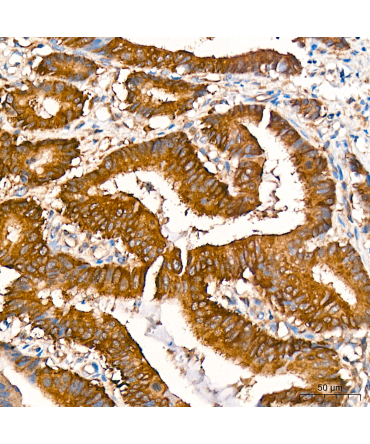 RALBP1 Rabbit Monoclonal Antibody