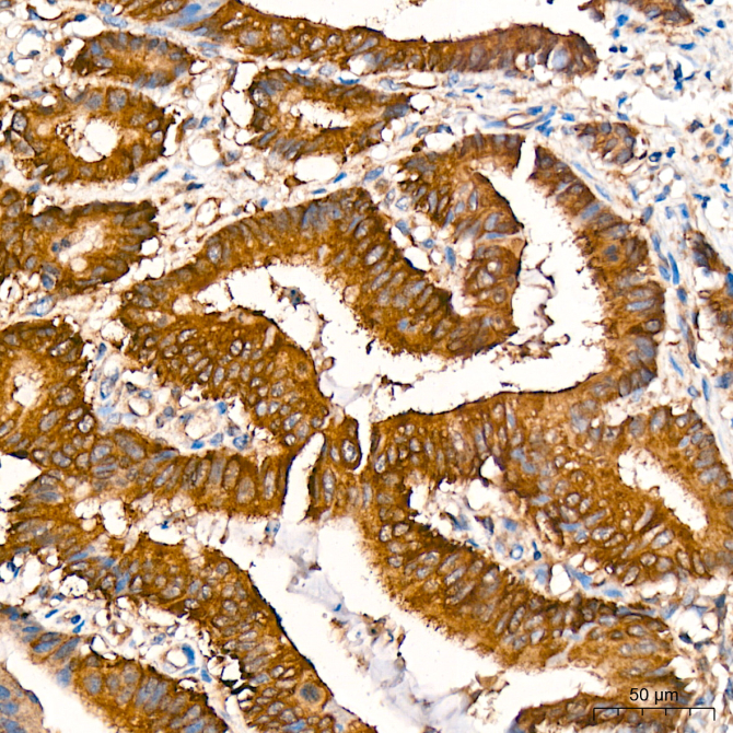 RALBP1 Rabbit Monoclonal Antibody