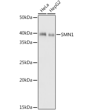 SMN1 Rabbit Monoclonal Antibody