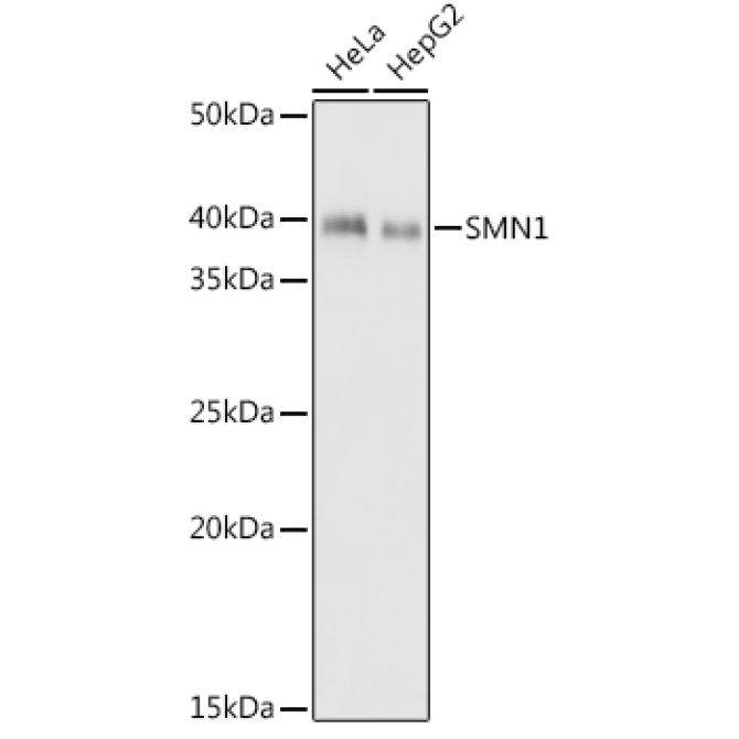 SMN1 Rabbit Monoclonal Antibody
