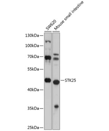 STK25 Rabbit Polyclonal Antibody