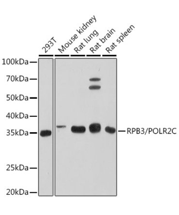 RPB3/POLR2C Rabbit Monoclonal Antibody