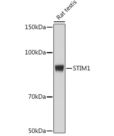 STIM1 Rabbit Monoclonal Antibody