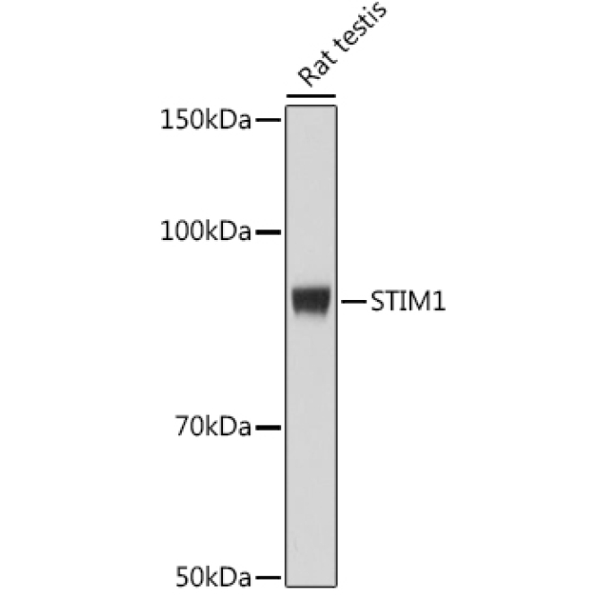STIM1 Rabbit Monoclonal Antibody