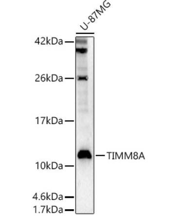 TIMM8A Rabbit Polyclonal Antibody