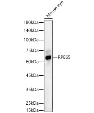RPE65 Rabbit Polyclonal Antibody