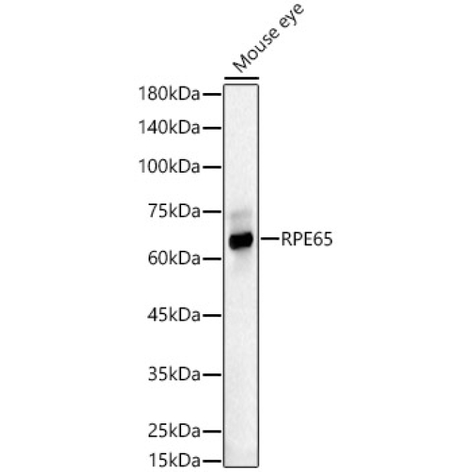 RPE65 Rabbit Polyclonal Antibody