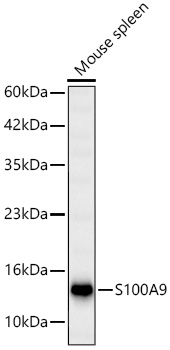 S100A9 Rabbit Polyclonal Antibody