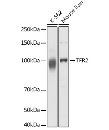 TFR2 Rabbit Polyclonal Antibody
