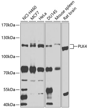 PLK4 Rabbit Polyclonal Antibody