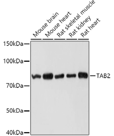 TAB2 Rabbit Polyclonal Antibody