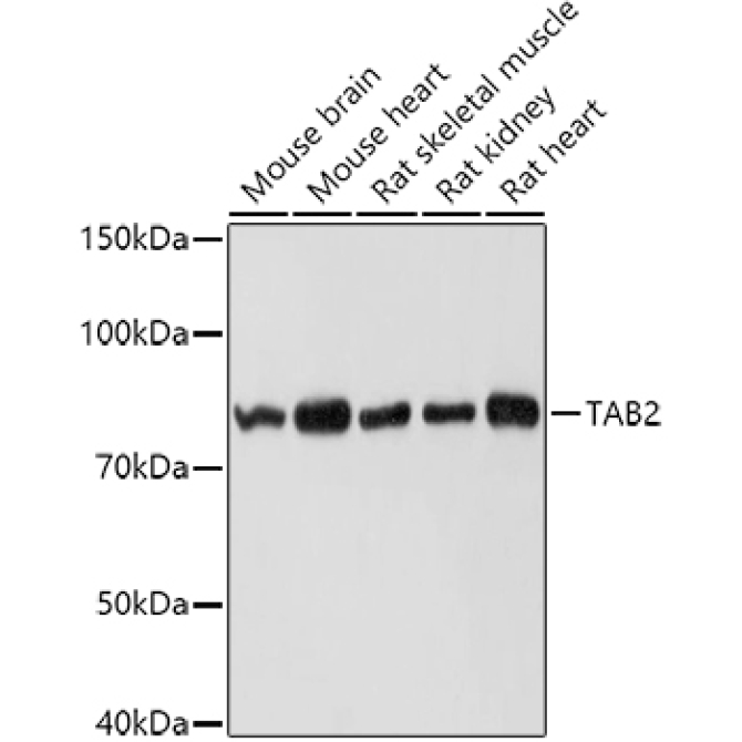 TAB2 Rabbit Polyclonal Antibody