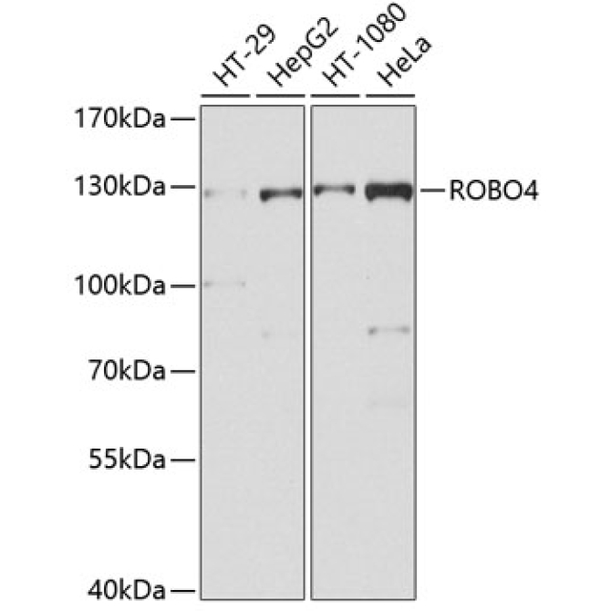 ROBO4 Rabbit Polyclonal Antibody