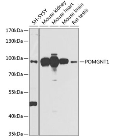 POMGNT1 Rabbit Polyclonal Antibody