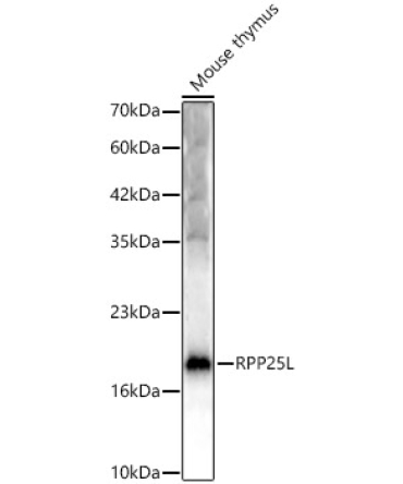 RPP25L Rabbit Polyclonal Antibody