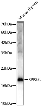 RPP25L Rabbit Polyclonal Antibody
