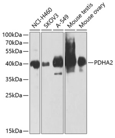 PDHA2 Rabbit Polyclonal Antibody