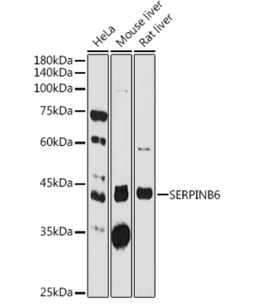 SERPINB6 Rabbit Polyclonal Antibody
