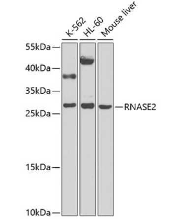 RNASE2 Rabbit Polyclonal Antibody