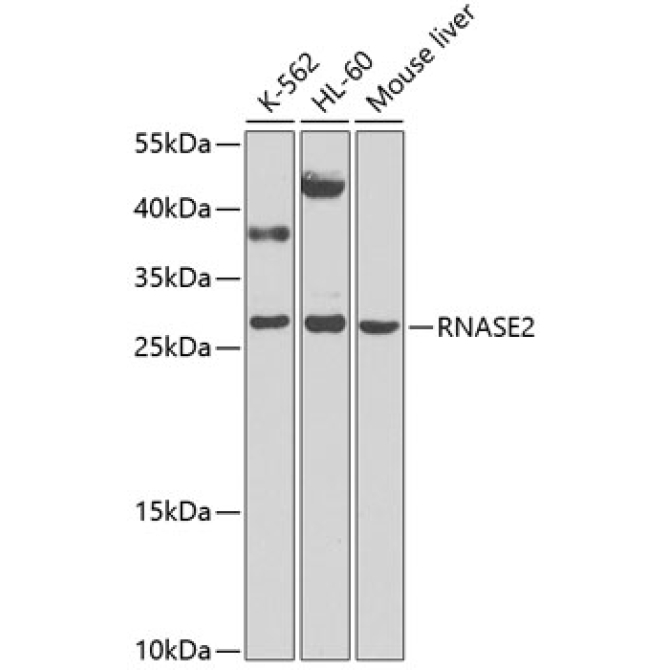 RNASE2 Rabbit Polyclonal Antibody