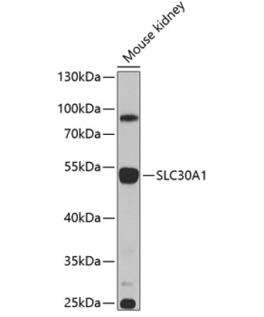 SLC30A1 Rabbit Polyclonal Antibody