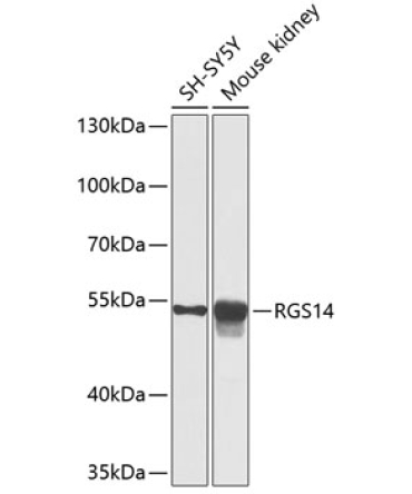 RGS14 Rabbit Polyclonal Antibody