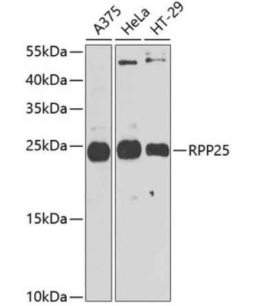 RPP25 Rabbit Polyclonal Antibody