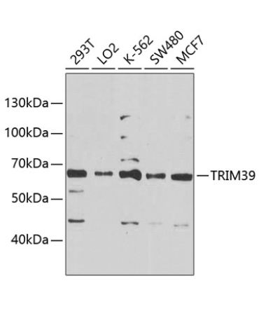 TRIM39 Rabbit Polyclonal Antibody