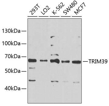 TRIM39 Rabbit Polyclonal Antibody