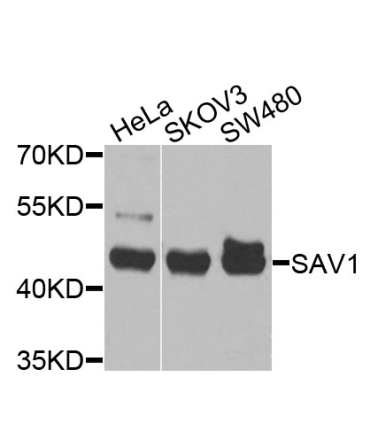 SAV1 Rabbit Polyclonal Antibody