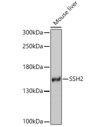 SSH2 Rabbit Polyclonal Antibody