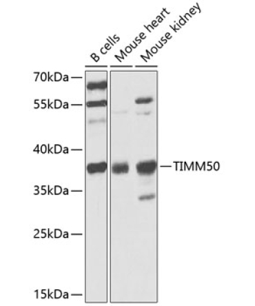 TIMM50 Rabbit Polyclonal Antibody